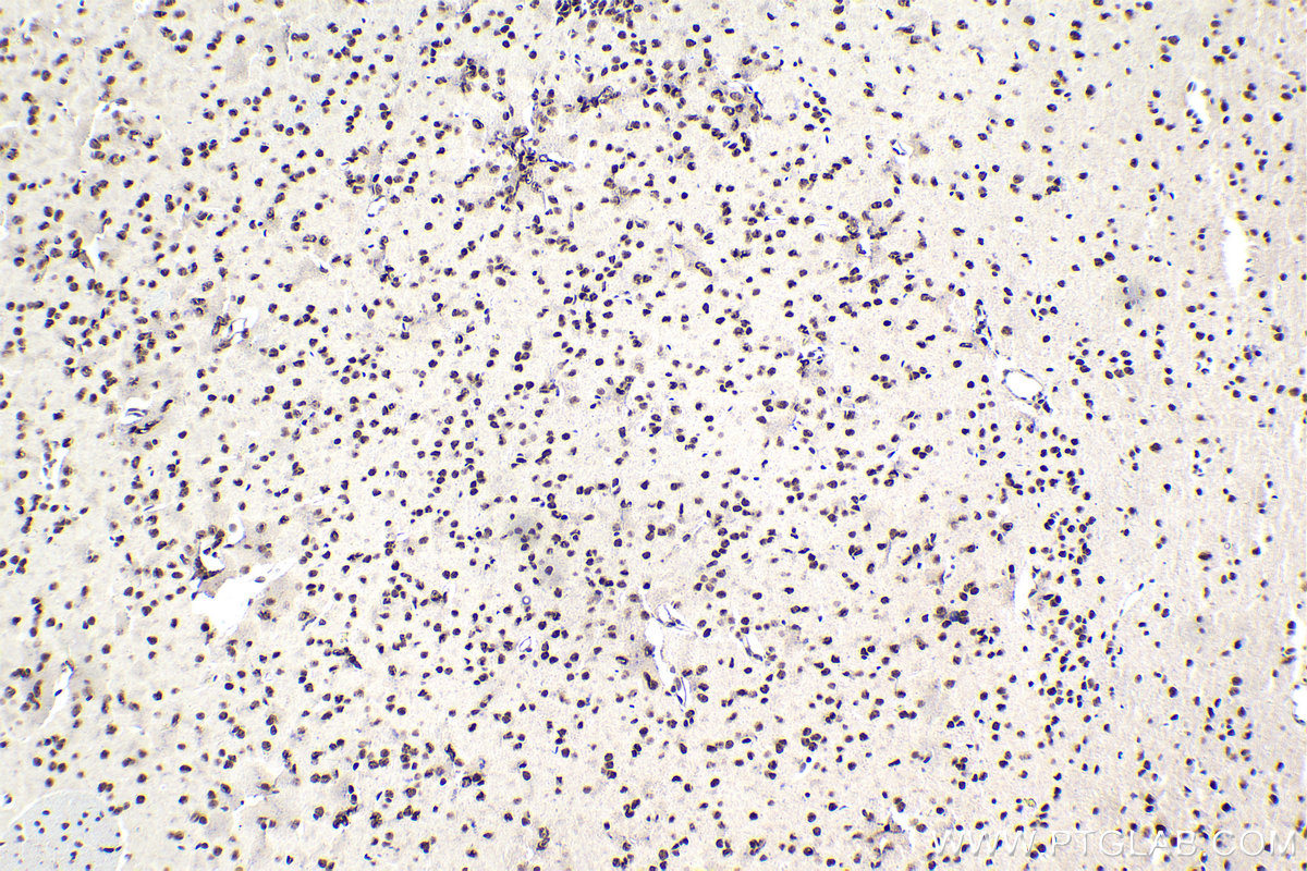 Immunohistochemical analysis of paraffin-embedded mouse brain tissue slide using KHC1710 (MTA1 IHC Kit).