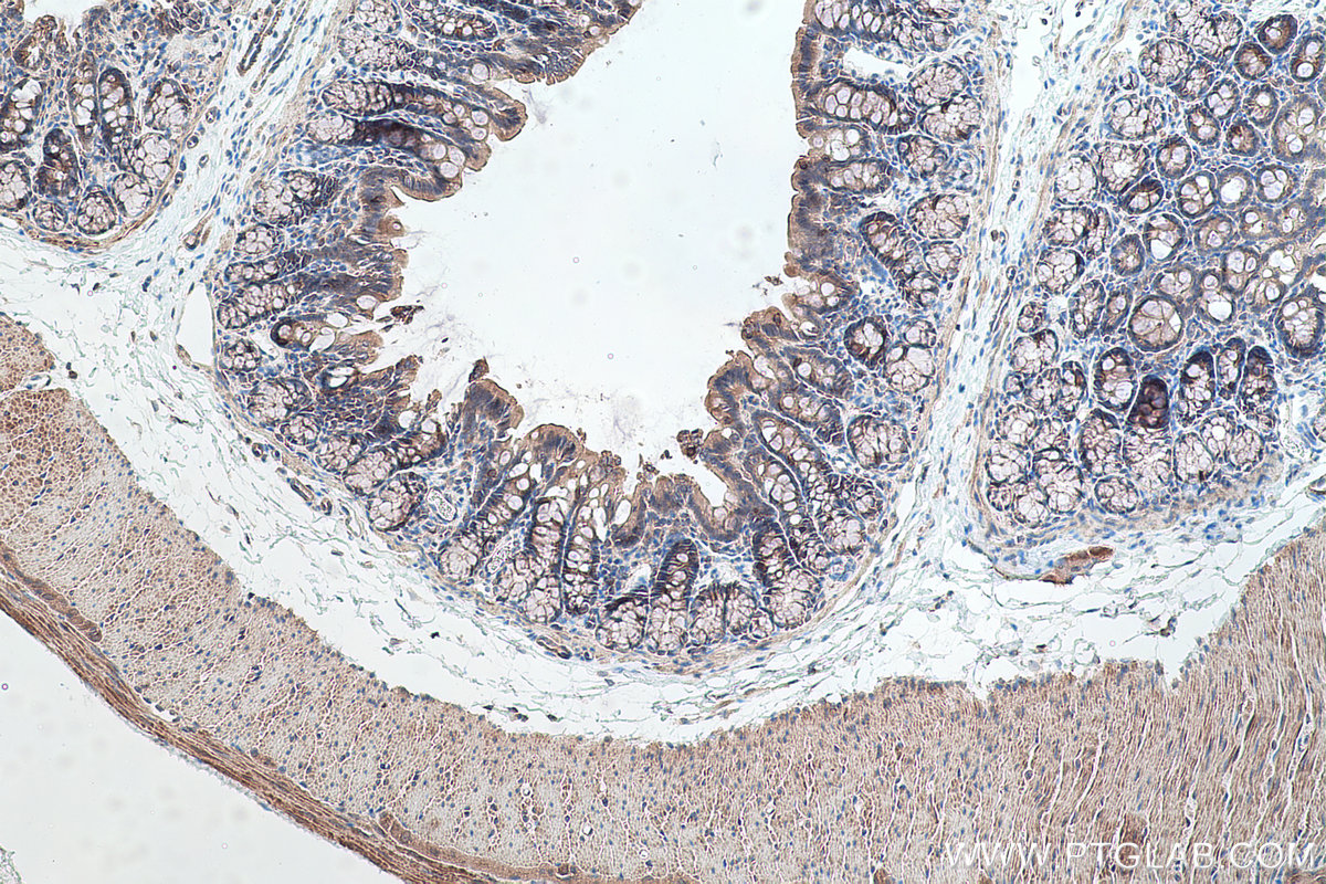 Immunohistochemical analysis of paraffin-embedded rat colon tissue slide using KHC0367 (MYO1B IHC Kit).