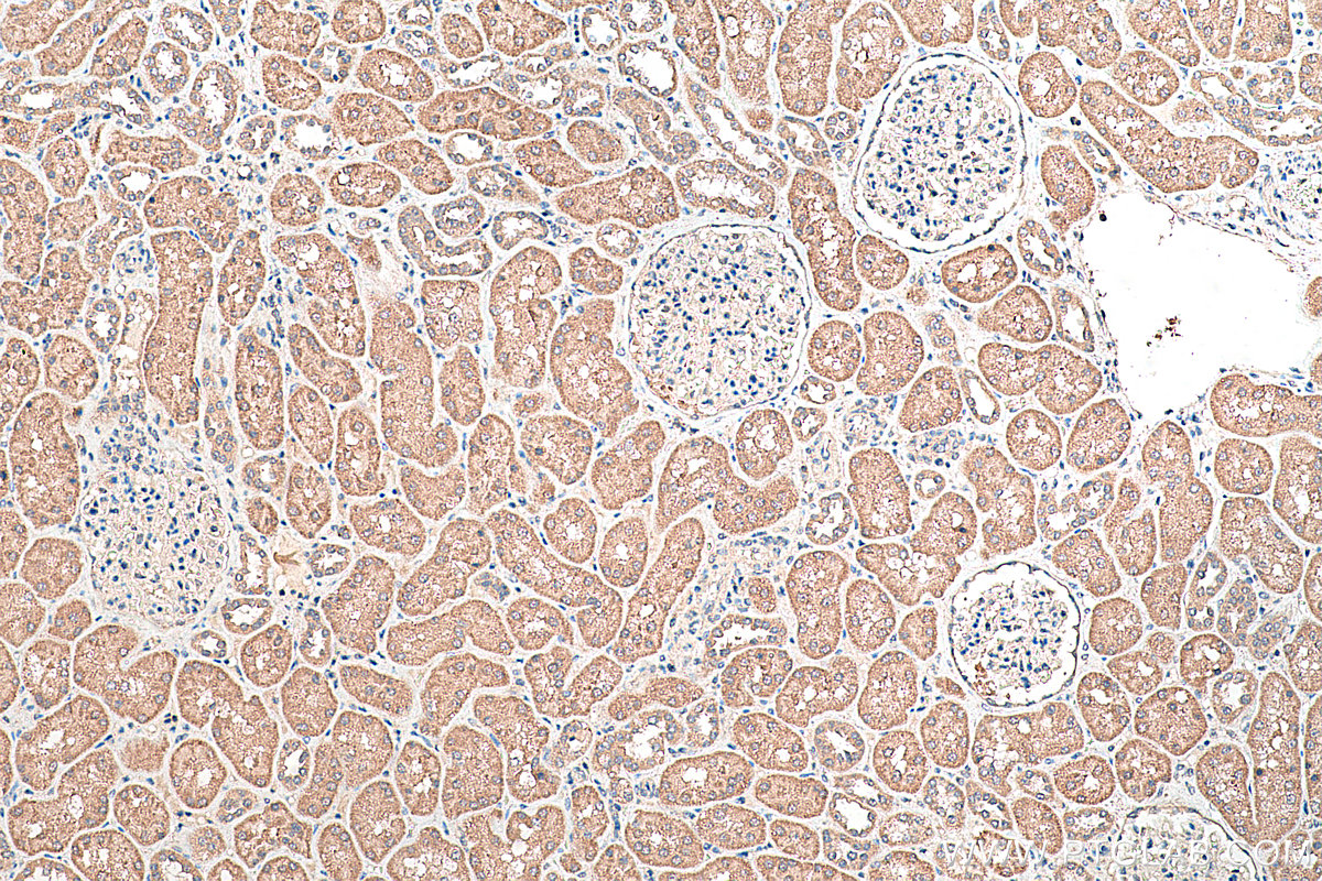 Immunohistochemical analysis of paraffin-embedded human kidney tissue slide using KHC0370 (MYO9A IHC Kit).