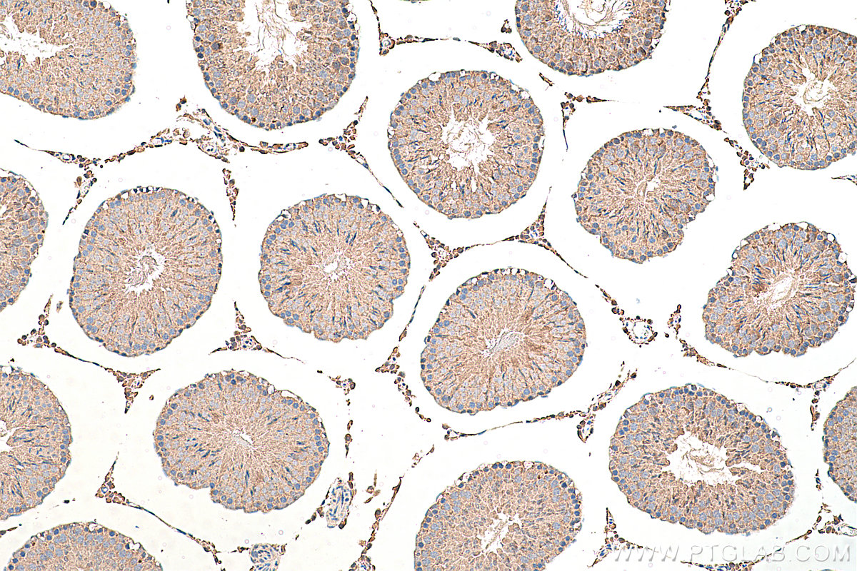 Immunohistochemical analysis of paraffin-embedded rat testis tissue slide using KHC0370 (MYO9A IHC Kit).