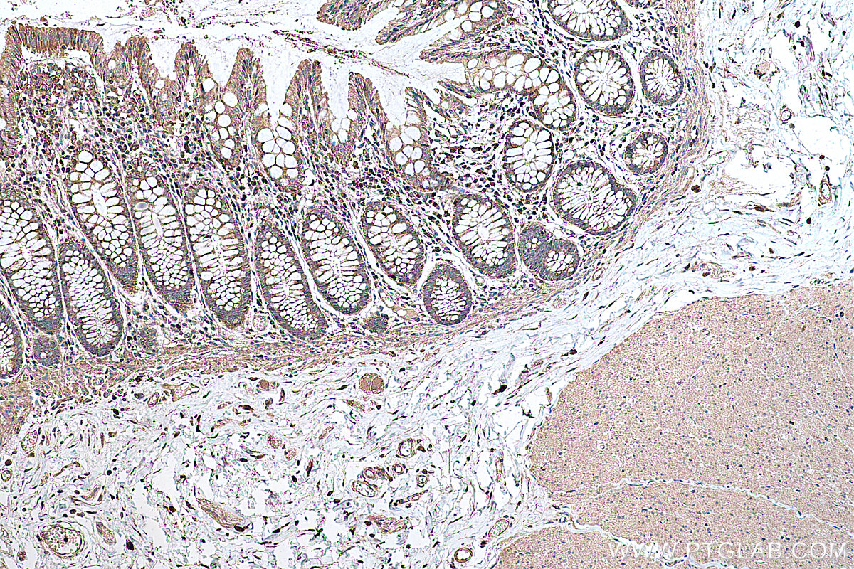 Immunohistochemical analysis of paraffin-embedded human colon tissue slide using KHC0371 (MYO9B IHC Kit).