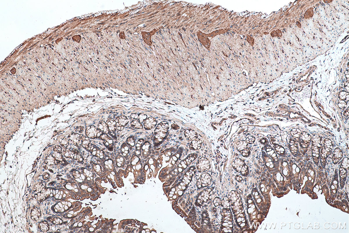 Immunohistochemical analysis of paraffin-embedded rat colon tissue slide using KHC0371 (MYO9B IHC Kit).