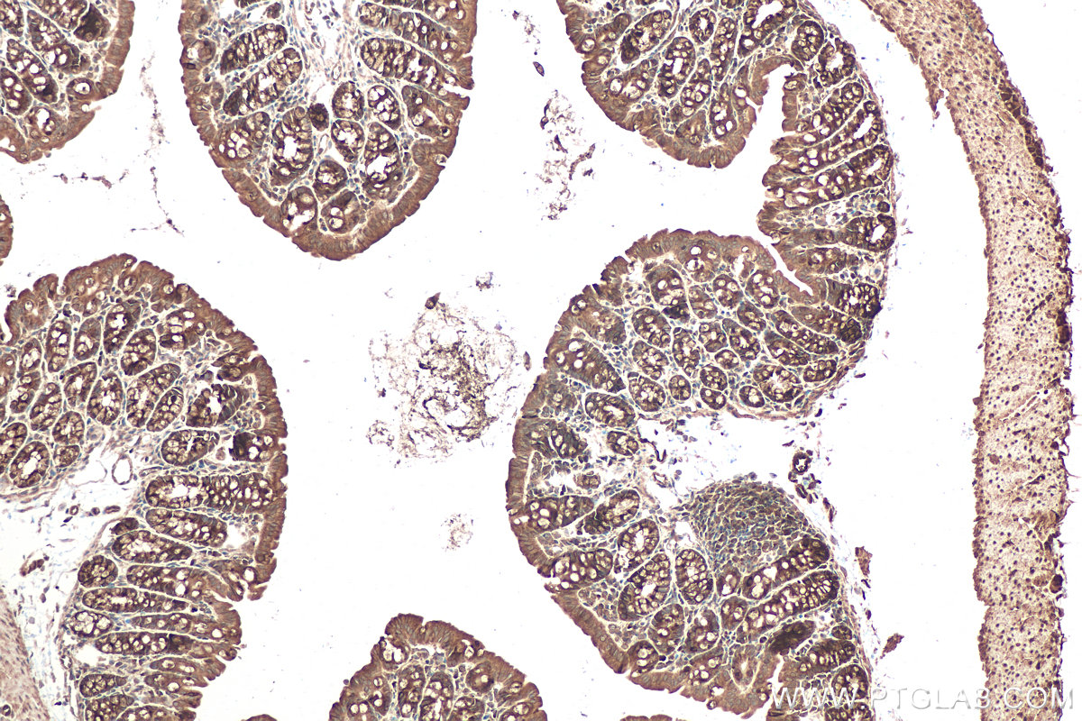 Immunohistochemical analysis of paraffin-embedded mouse colon tissue slide using KHC0950 (NAA10/ARD1A IHC Kit).
