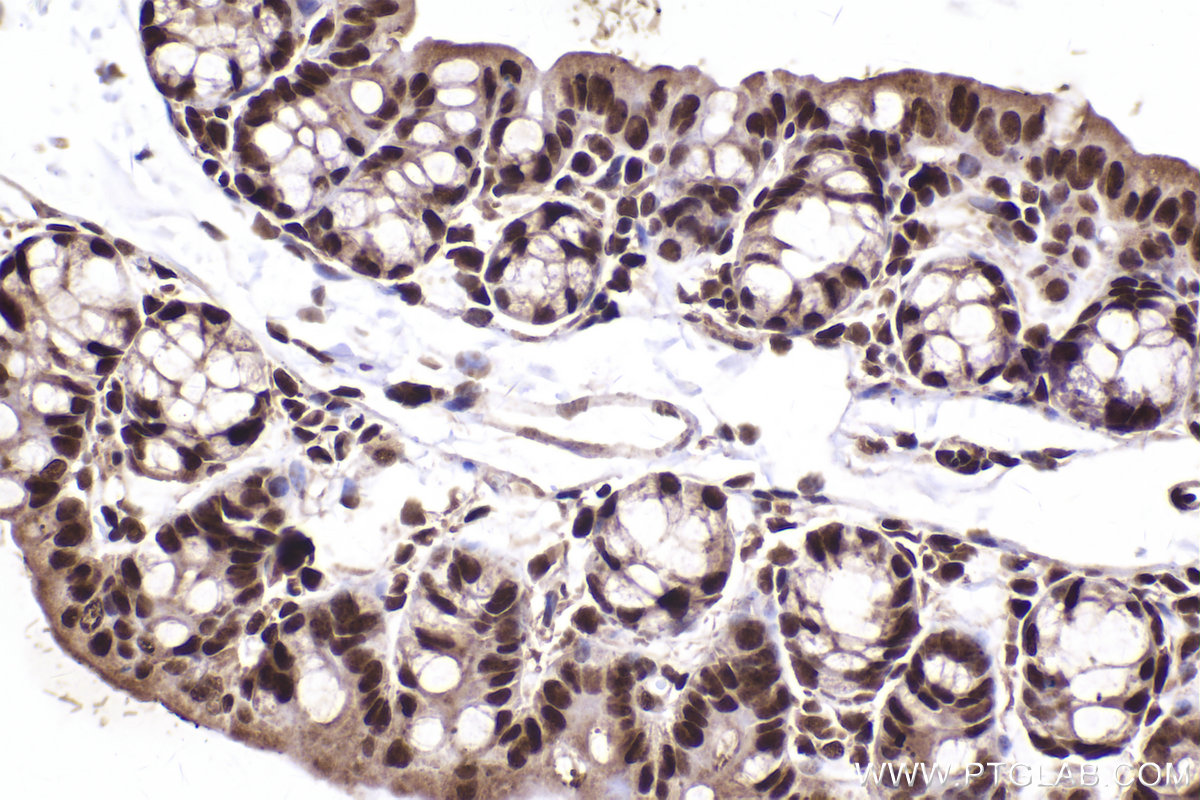 Immunohistochemical analysis of paraffin-embedded mouse small intestine tissue slide using KHC2435 (NAE1/APPBP1 IHC Kit).