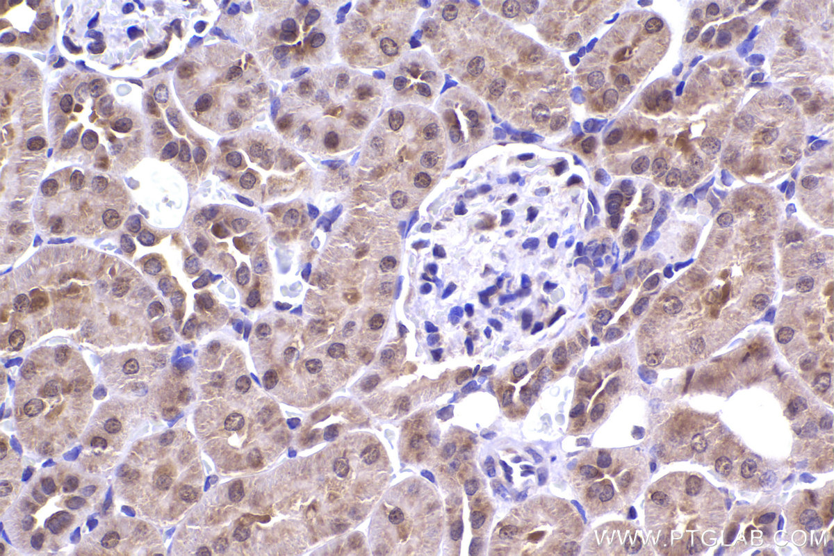 Immunohistochemical analysis of paraffin-embedded rat kidney tissue slide using KHC2339 (NAT5 IHC Kit).