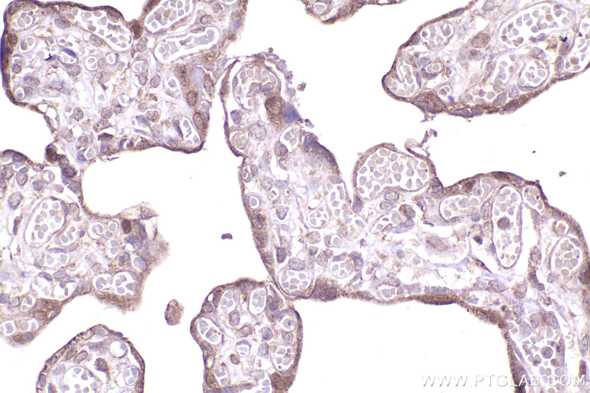 Immunohistochemical analysis of paraffin-embedded human placenta tissue slide using KHC2478 (NCAPD2 IHC Kit).