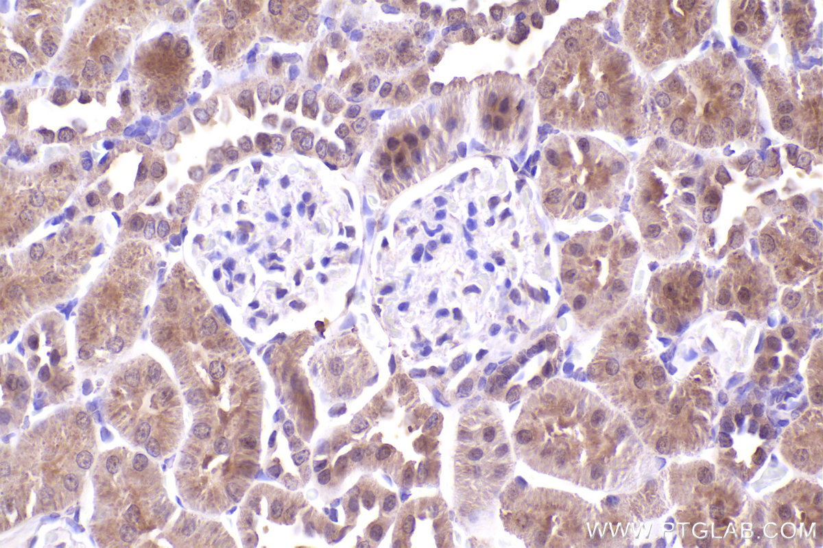 Immunohistochemical analysis of paraffin-embedded rat kidney tissue slide using KHC2478 (NCAPD2 IHC Kit).