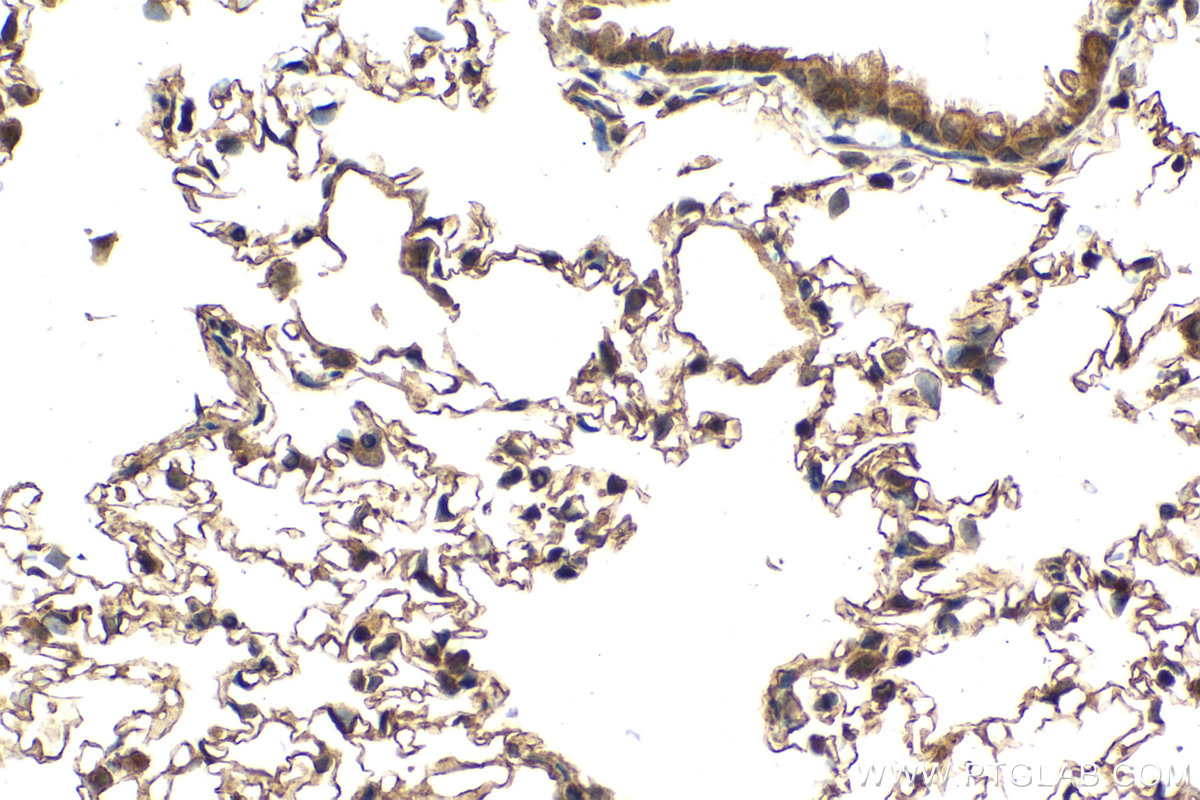 Immunohistochemical analysis of paraffin-embedded rat lung tissue slide using KHC2090 (NCK2 IHC Kit).