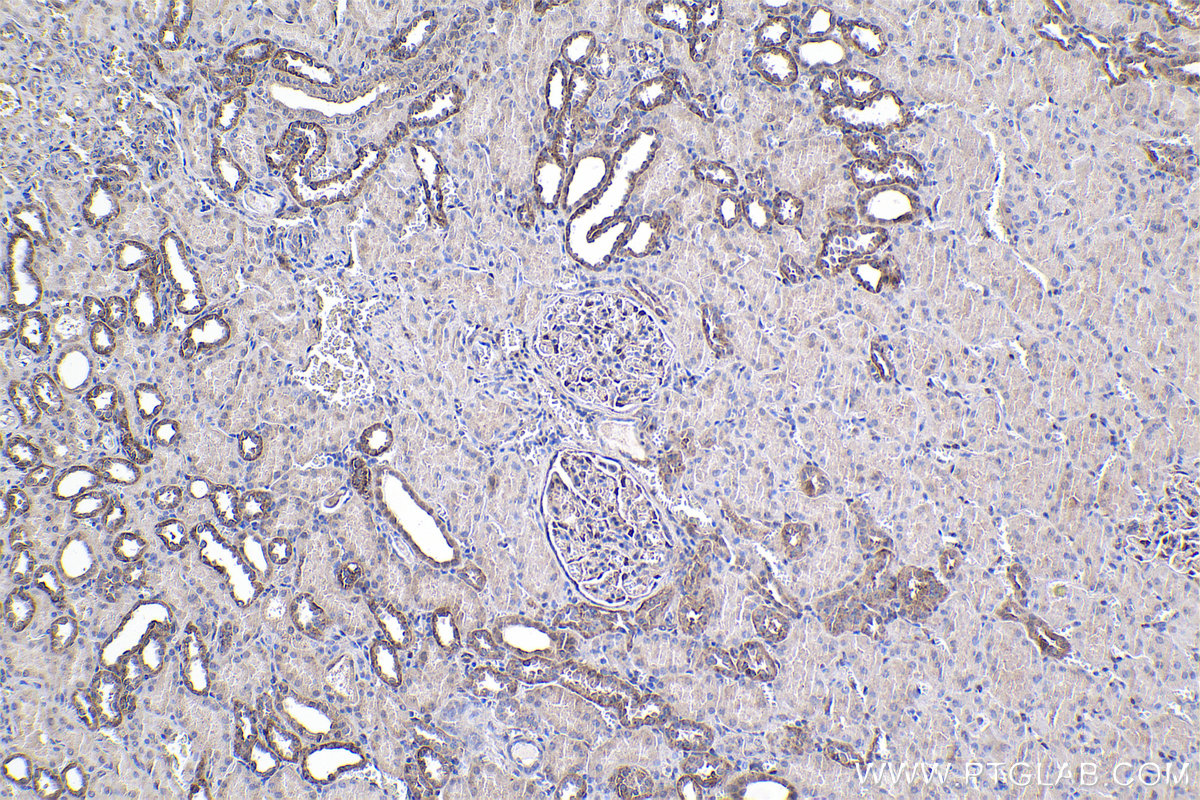 Immunohistochemical analysis of paraffin-embedded human kidney tissue slide using KHC1010 (NDRG2 IHC Kit).