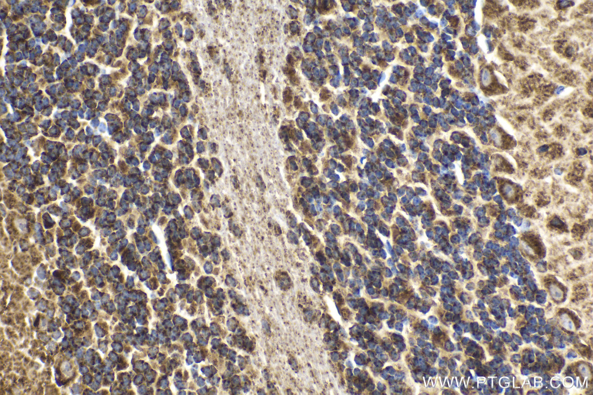 Immunohistochemical analysis of paraffin-embedded mouse cerebellum tissue slide using KHC2114 (NDUFS3 IHC Kit).