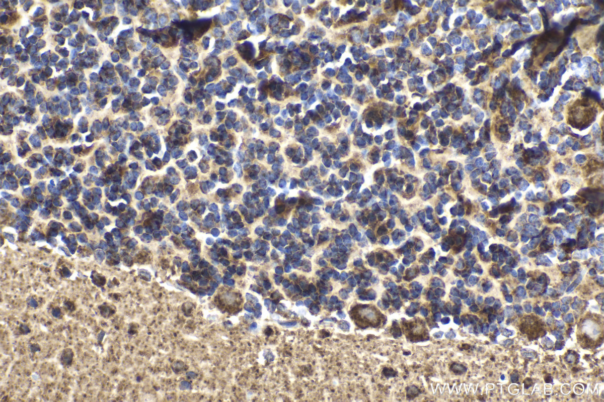 Immunohistochemical analysis of paraffin-embedded rat cerebellum tissue slide using KHC2114 (NDUFS3 IHC Kit).