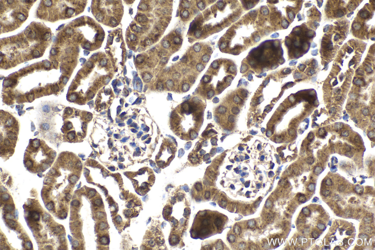 Immunohistochemical analysis of paraffin-embedded mouse kidney tissue slide using KHC2114 (NDUFS3 IHC Kit).