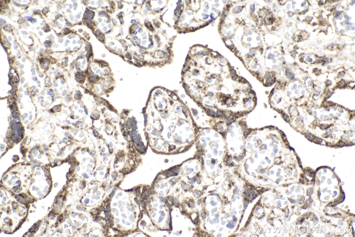 Immunohistochemical analysis of paraffin-embedded human placenta tissue slide using KHC2114 (NDUFS3 IHC Kit).