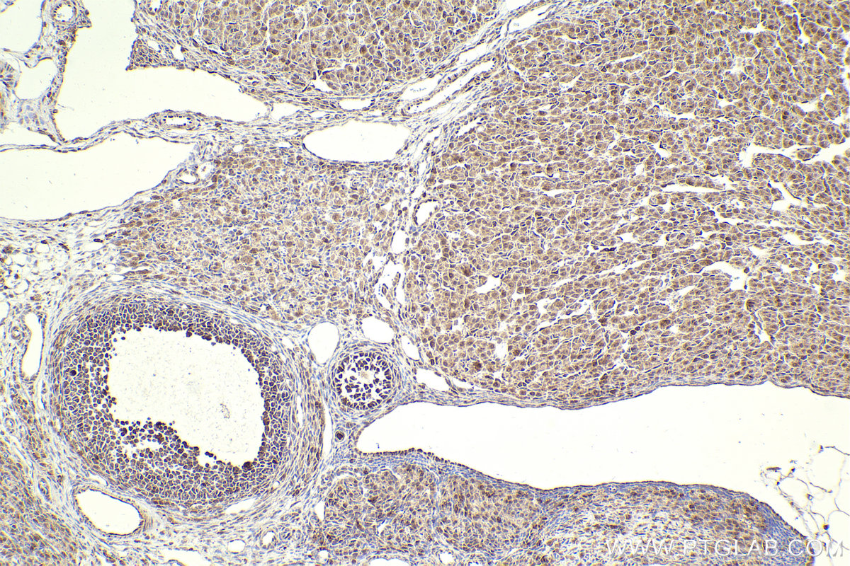 Immunohistochemical analysis of paraffin-embedded rat ovary tissue slide using KHC2307 (NEK2 IHC Kit).