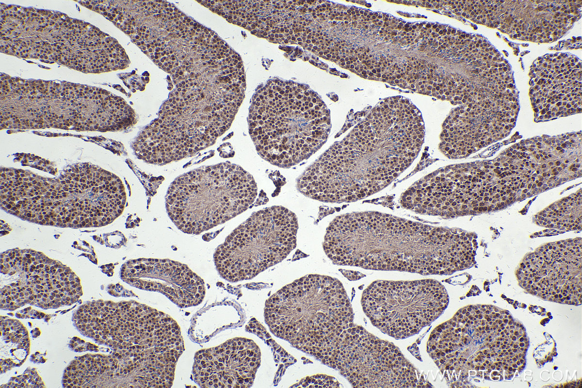 Immunohistochemical analysis of paraffin-embedded mouse testis tissue slide using KHC2307 (NEK2 IHC Kit).