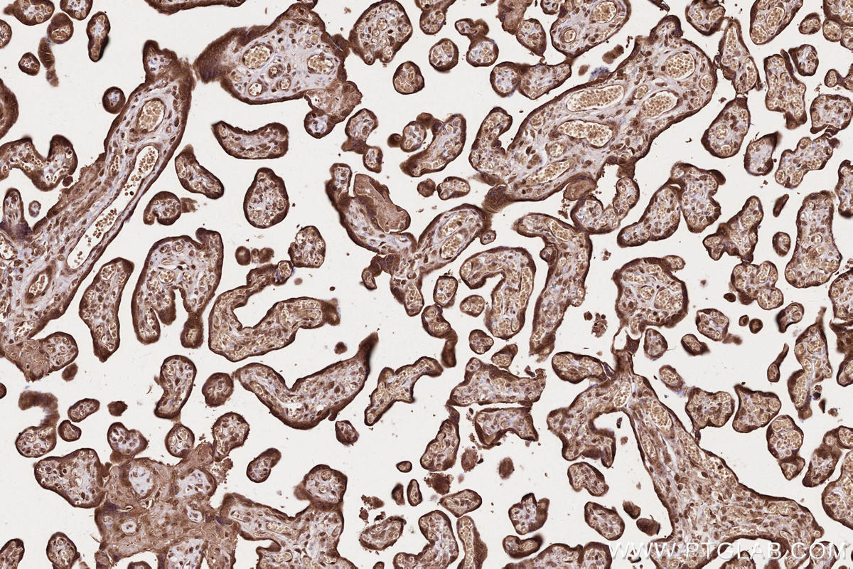 Immunohistochemical analysis of paraffin-embedded human placenta tissue slide using KHC2623 (NET1 IHC Kit).