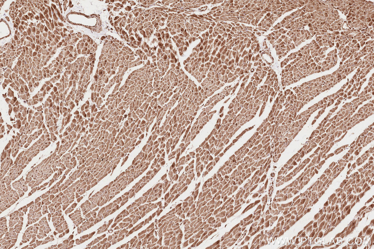 Immunohistochemical analysis of paraffin-embedded rat heart tissue slide using KHC2623 (NET1 IHC Kit).