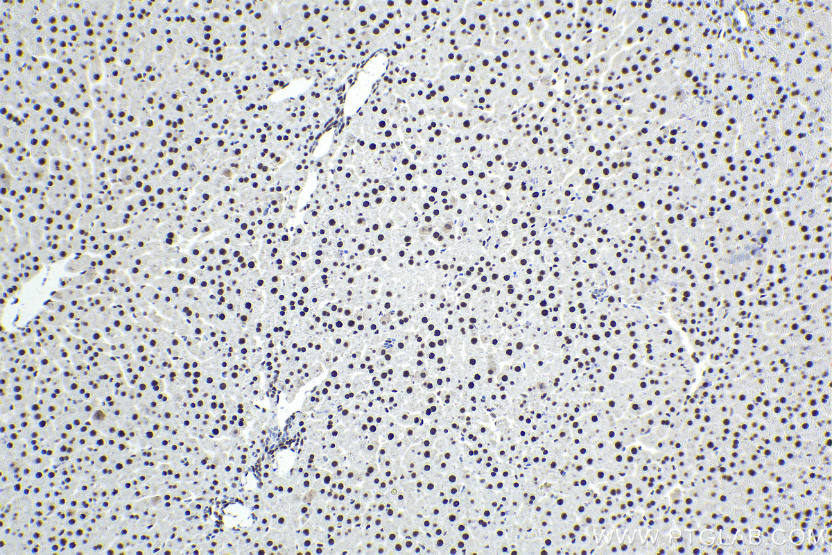 Immunohistochemical analysis of paraffin-embedded rat liver tissue slide using KHC1693 (NFIA IHC Kit).