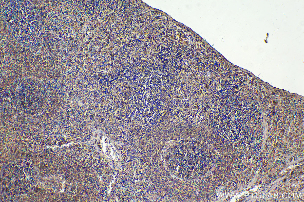 Immunohistochemical analysis of paraffin-embedded rat spleen tissue slide using KHC2200 (NCF2 IHC Kit).