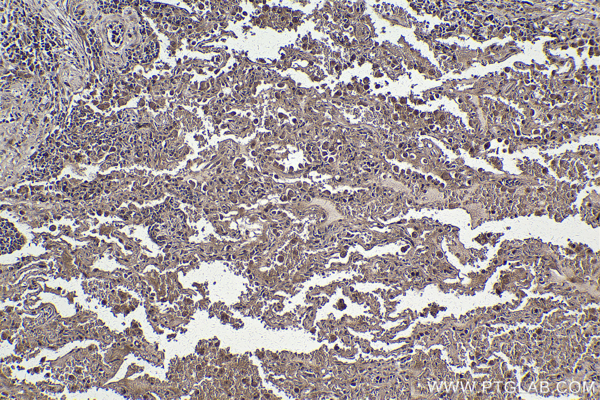 Immunohistochemical analysis of paraffin-embedded human lung tissue slide using KHC2200 (NCF2 IHC Kit).