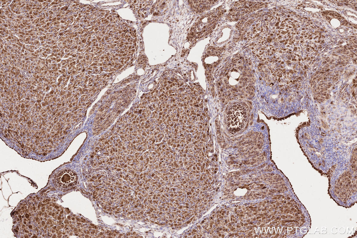 Immunohistochemical analysis of paraffin-embedded rat ovary tissue slide using KHC2621 (NPHP3 IHC Kit).