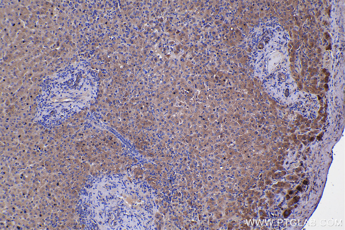 Immunohistochemical analysis of paraffin-embedded human liver tissue slide using KHC2314 (NUDT6 IHC Kit).