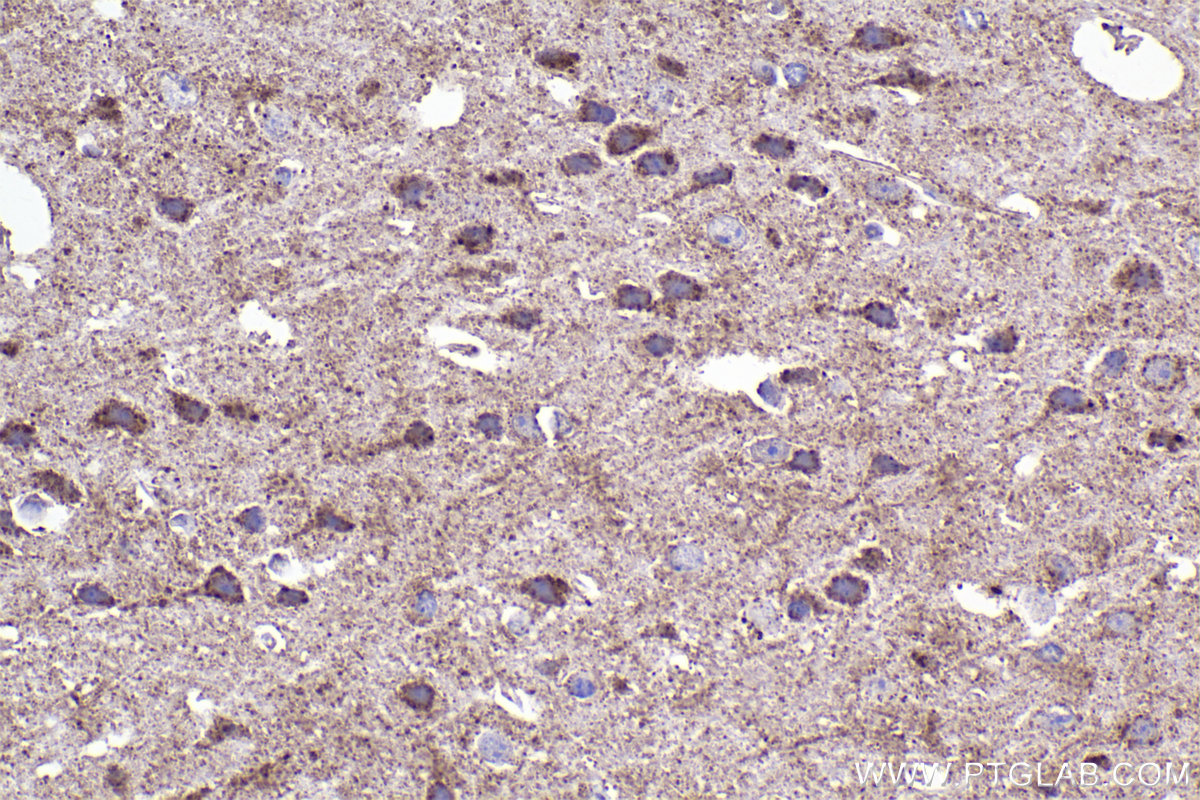 Immunohistochemical analysis of paraffin-embedded mouse brain tissue slide using KHC2314 (NUDT6 IHC Kit).