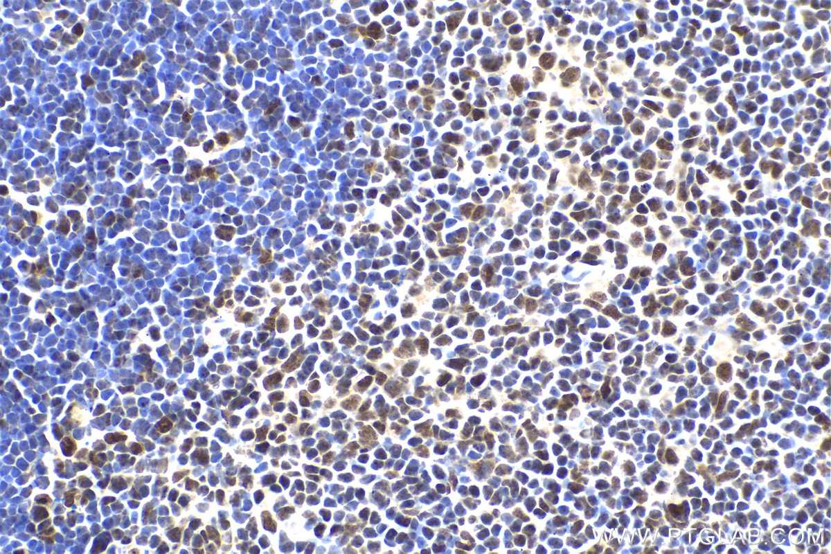 Immunohistochemical analysis of paraffin-embedded mouse thymus tissue slide using KHC1984 (NUFIP1 IHC Kit).