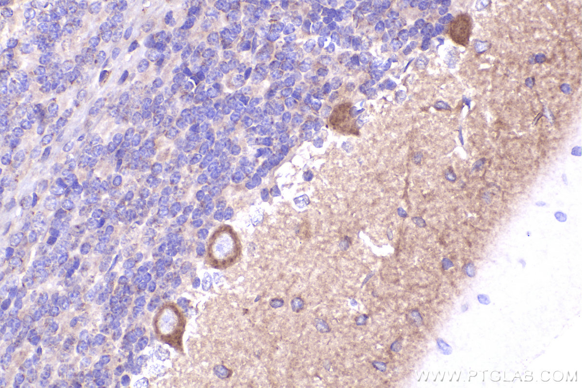 Immunohistochemical analysis of paraffin-embedded rat cerebellum tissue slide using KHC2283 (Nestin IHC Kit).