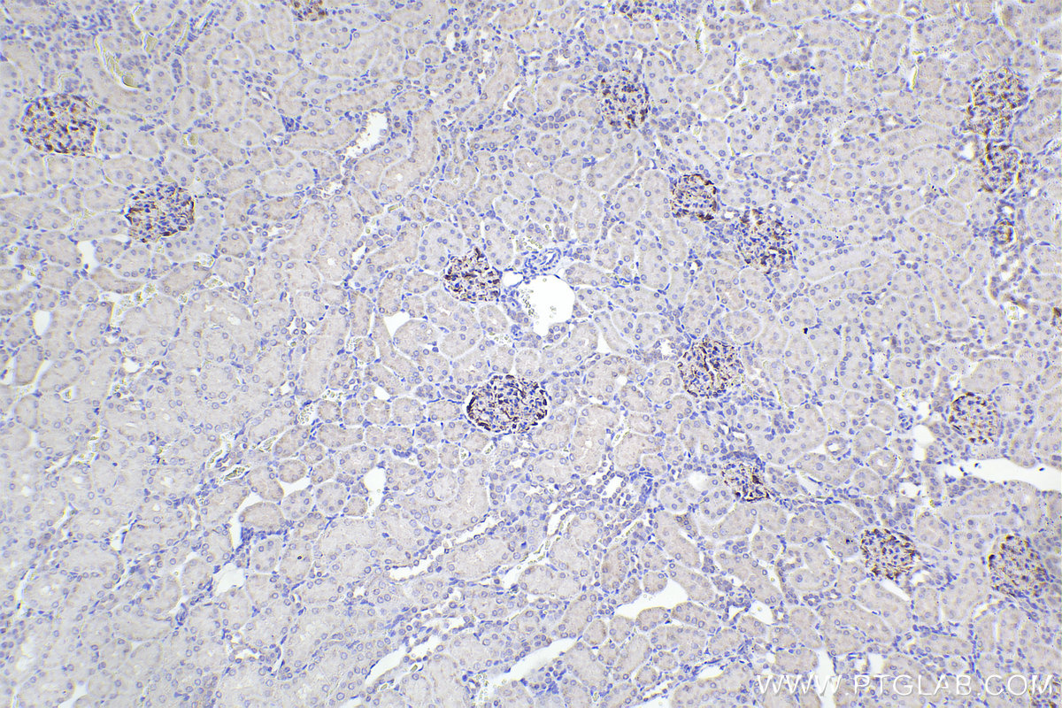 Immunohistochemical analysis of paraffin-embedded rat kidney tissue slide using KHC2283 (Nestin IHC Kit).