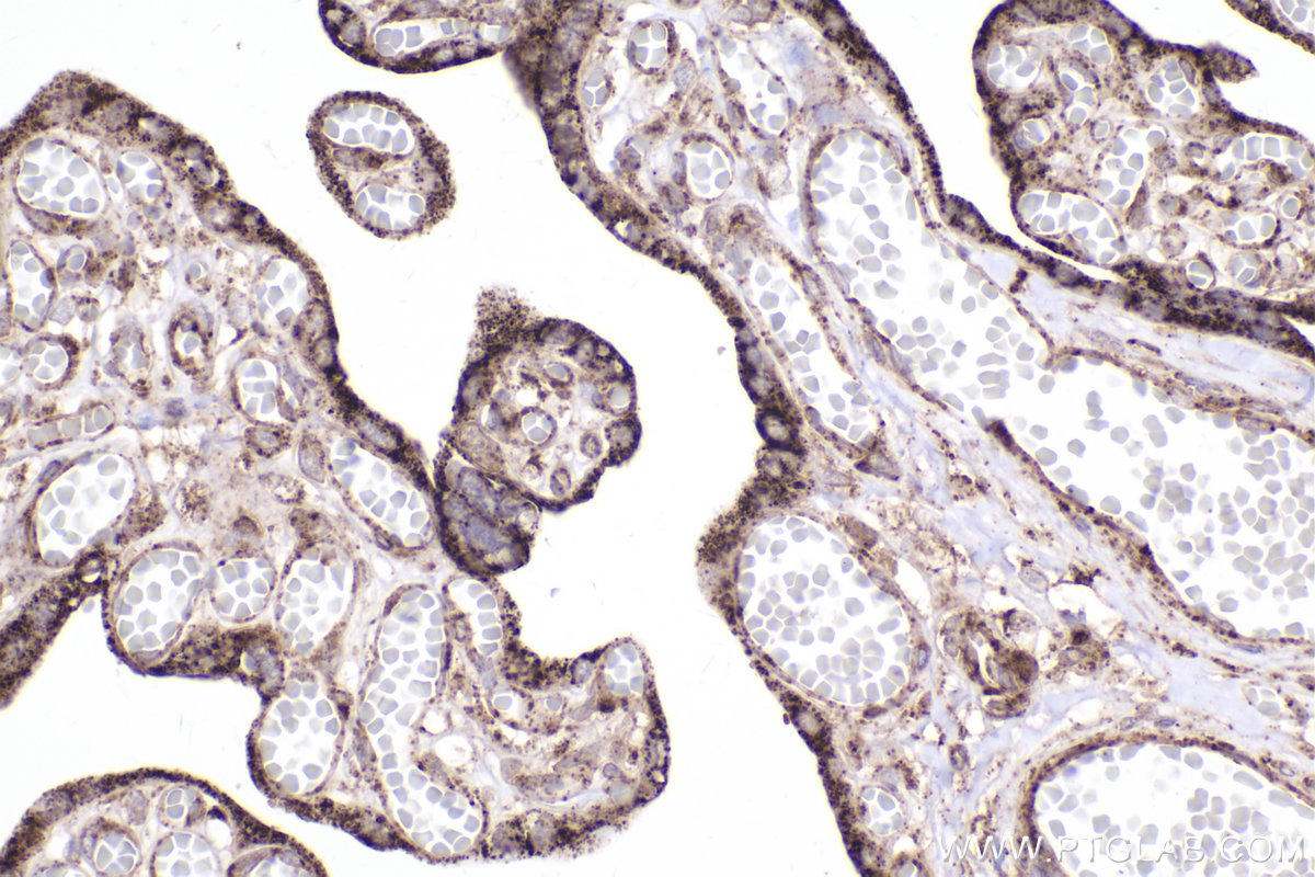 Immunohistochemical analysis of paraffin-embedded human placenta tissue slide using KHC2386 (OGDH IHC Kit).