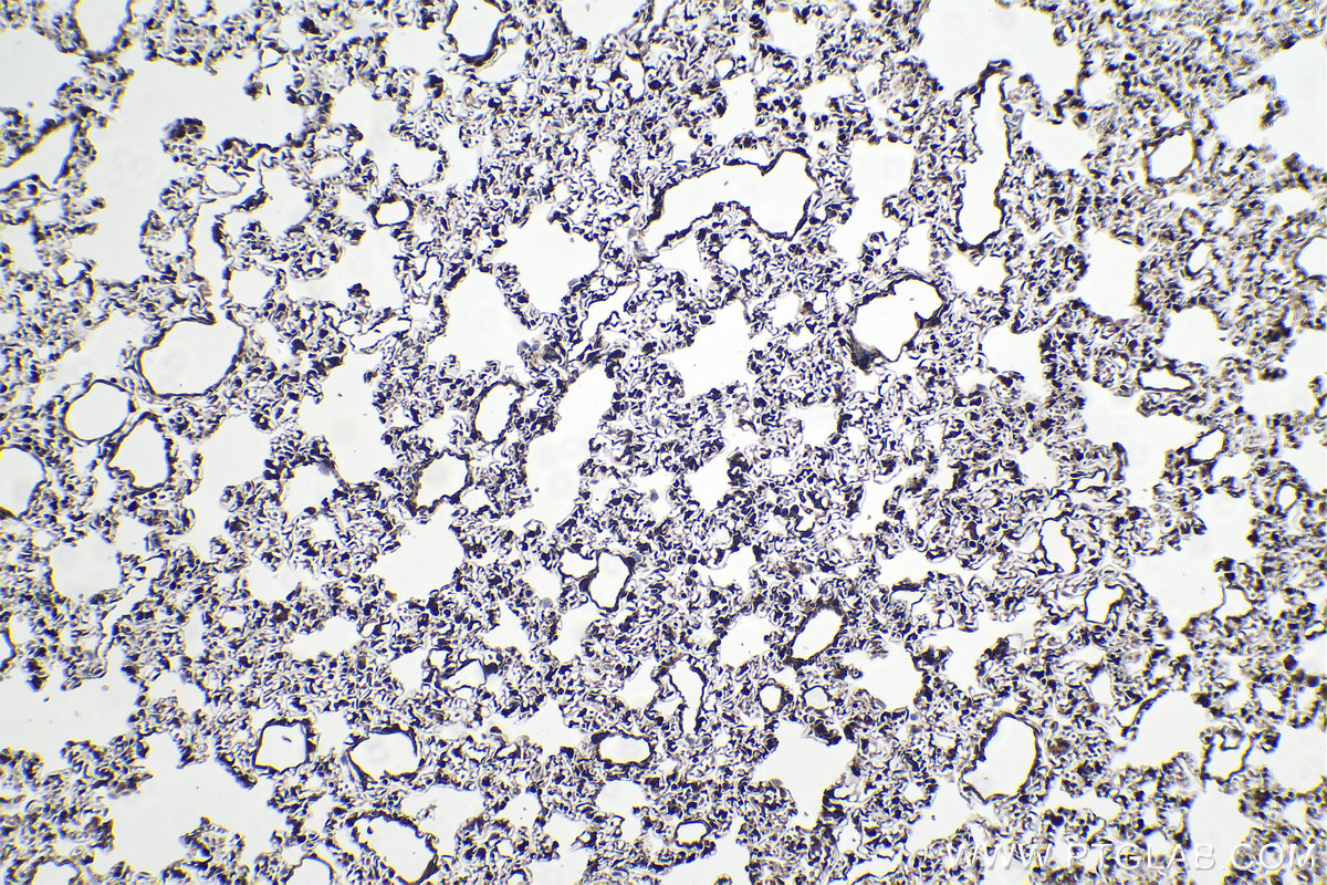 Immunohistochemical analysis of paraffin-embedded rat lung tissue slide using KHC1229 (P4HA1 IHC Kit).