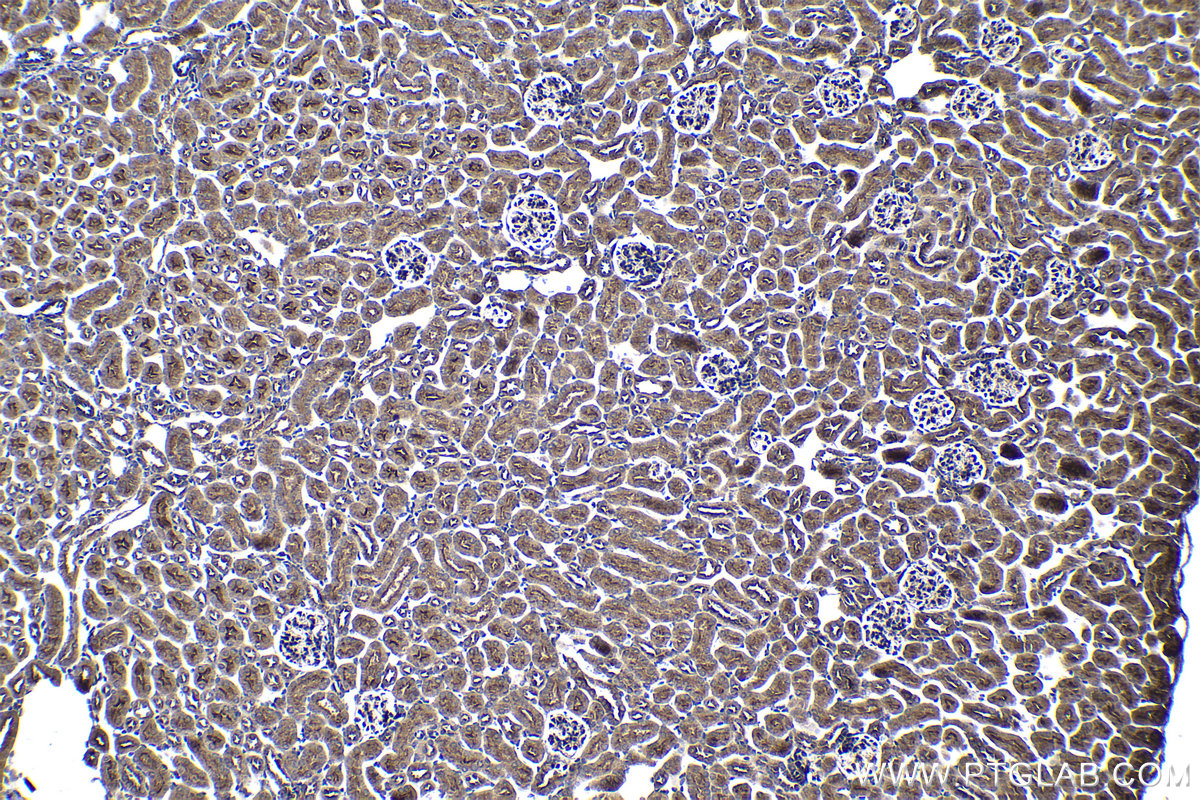 Immunohistochemical analysis of paraffin-embedded mouse kidney tissue slide using KHC1369 (P4HA2 IHC Kit).