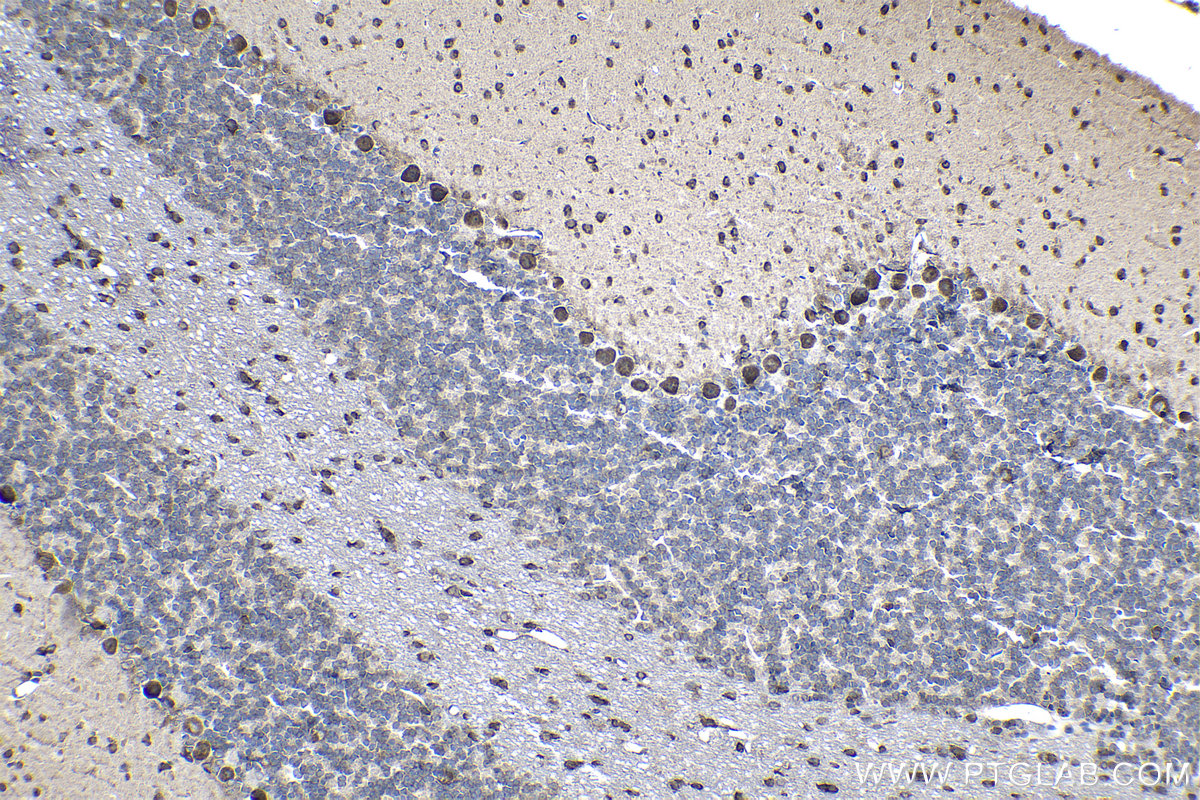 Immunohistochemical analysis of paraffin-embedded rat cerebellum tissue slide using KHC1141 (PABPC1 IHC Kit).