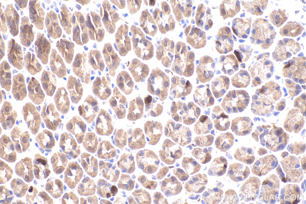 Immunohistochemical analysis of paraffin-embedded mouse stomach tissue slide using KHC2458 (PAK1 IHC Kit).