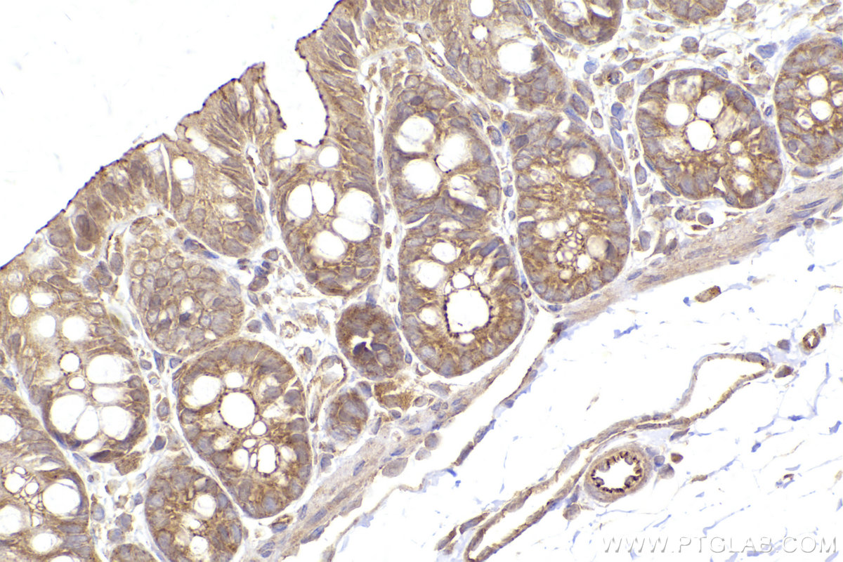 Immunohistochemical analysis of paraffin-embedded rat colon tissue slide using KHC2420 (PAK2 IHC Kit).