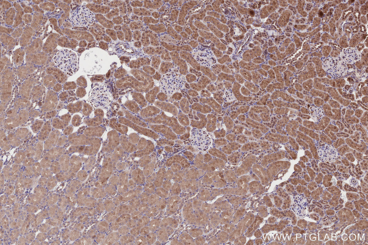 Immunohistochemical analysis of paraffin-embedded rat kidney tissue slide using KHC2688 (PAPD5 IHC Kit).