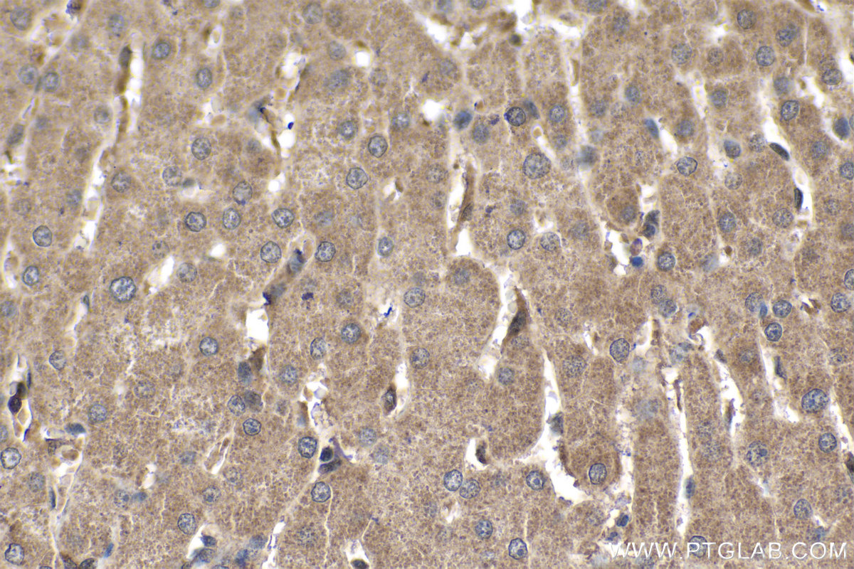 Immunohistochemical analysis of paraffin-embedded human liver tissue slide using KHC1773 (PARP10 IHC Kit).