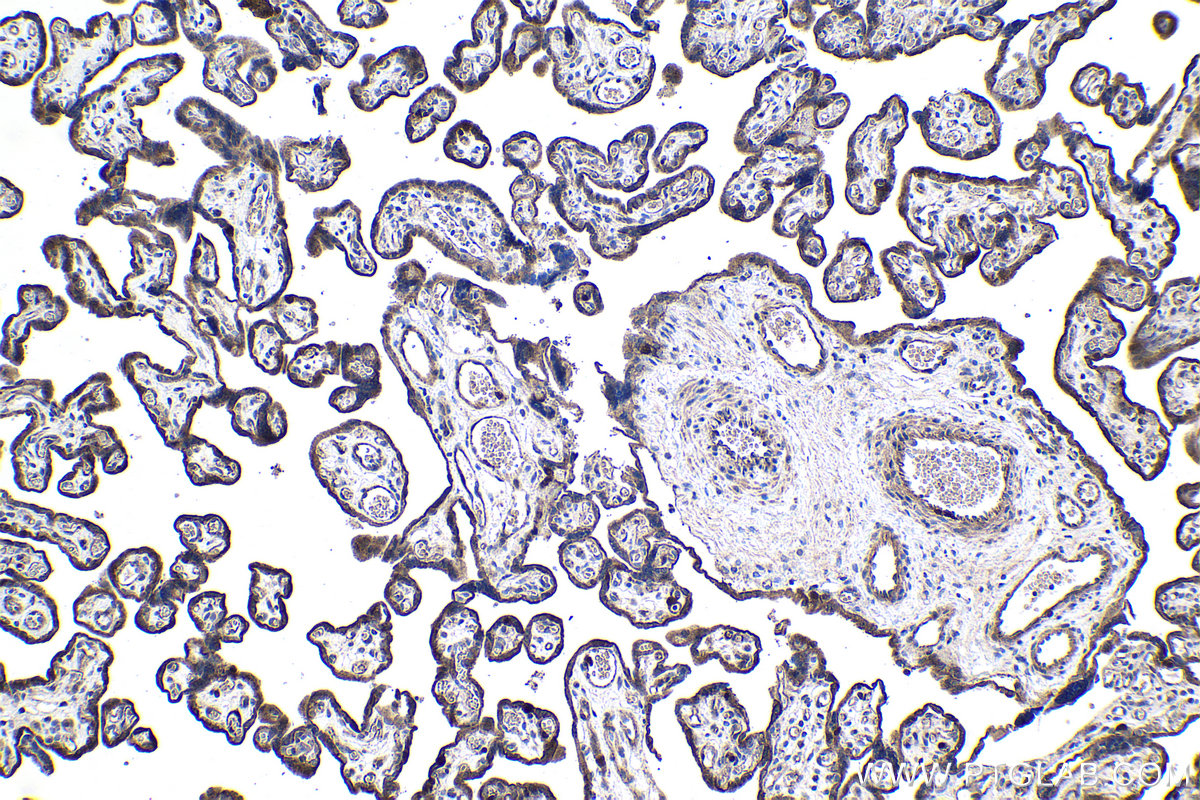 Immunohistochemical analysis of paraffin-embedded human placenta tissue slide using KHC1034 (PBK IHC Kit).