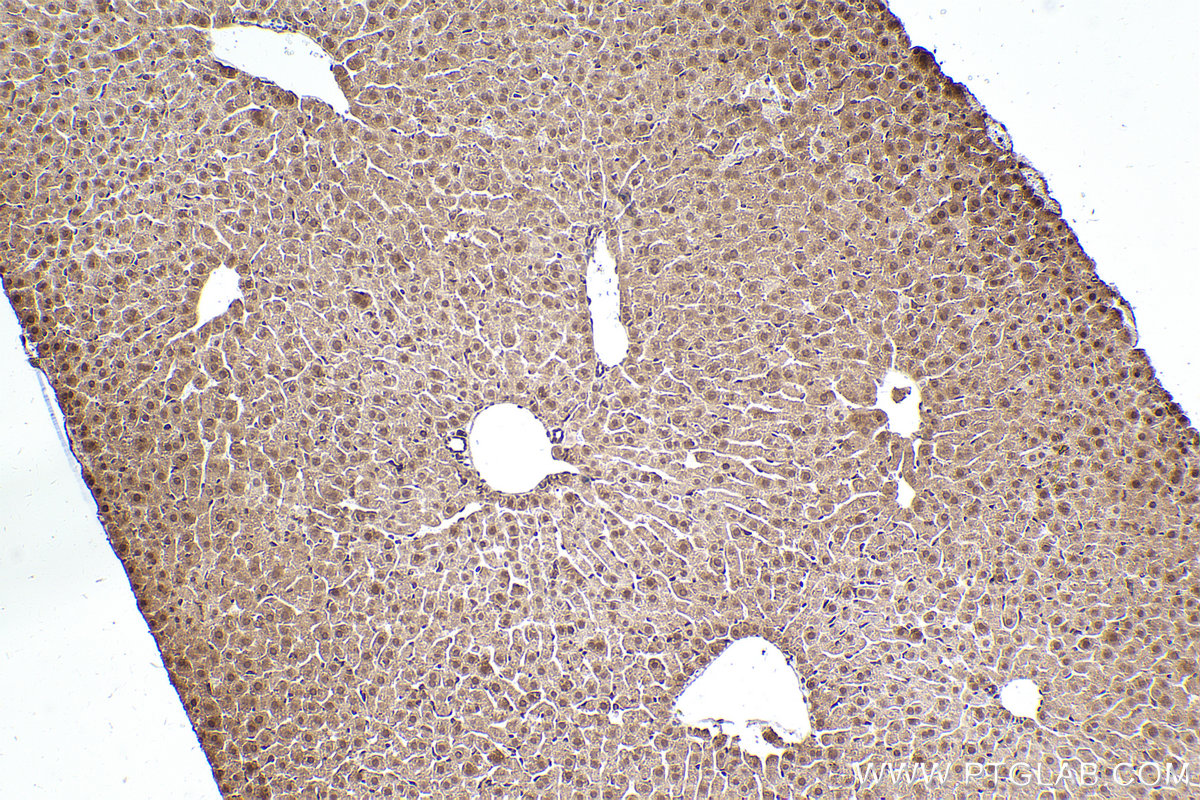 Immunohistochemical analysis of paraffin-embedded mouse liver tissue slide using KHC2486 (PCBP2 IHC Kit).