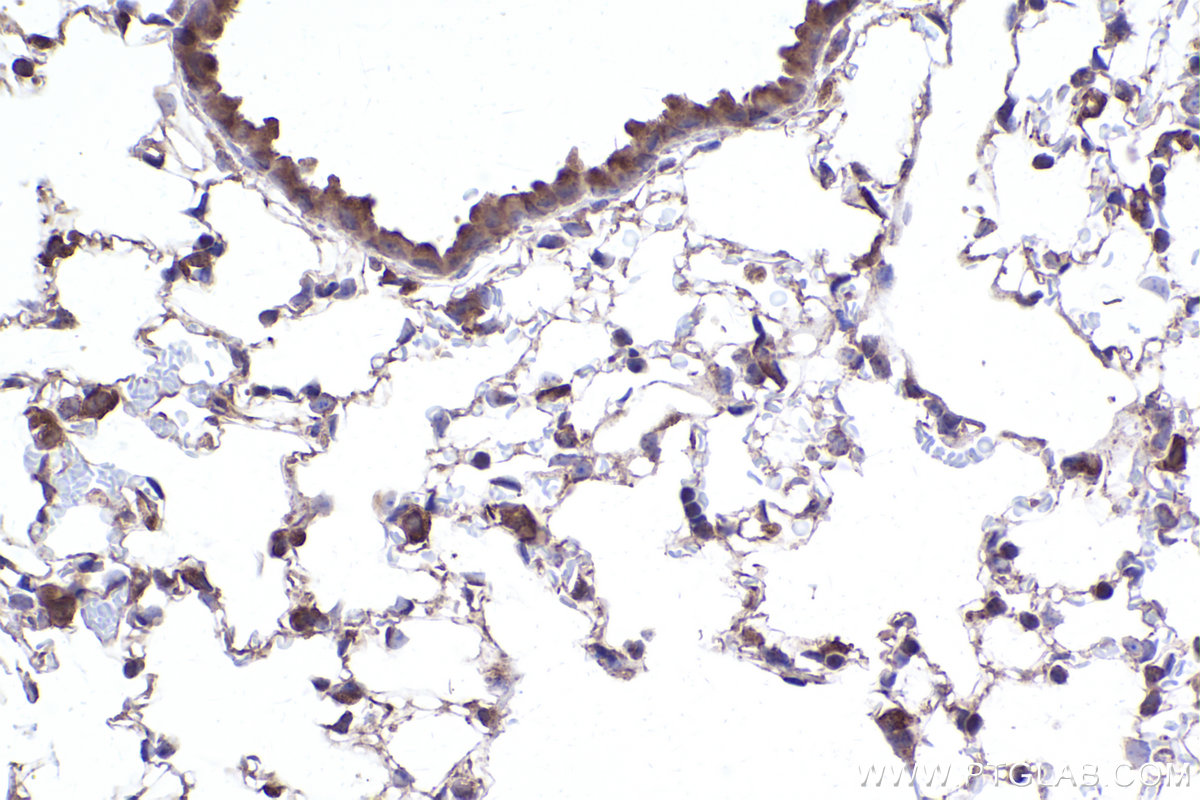 Immunohistochemical analysis of paraffin-embedded mouse lung tissue slide using KHC2398 (PCTAIRE3 IHC Kit).