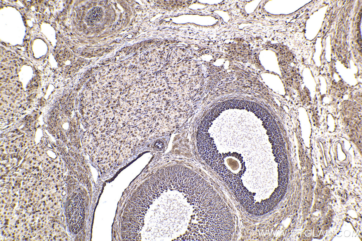 Immunohistochemical analysis of paraffin-embedded rat ovary tissue slide using KHC2532 (PDCD4 IHC Kit).