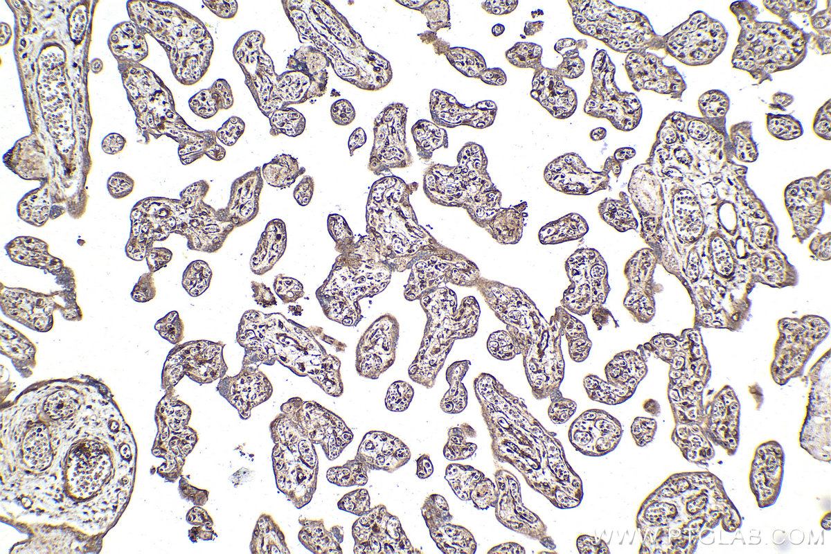Immunohistochemical analysis of paraffin-embedded human placenta tissue slide using KHC2126 (PDE5A IHC Kit).