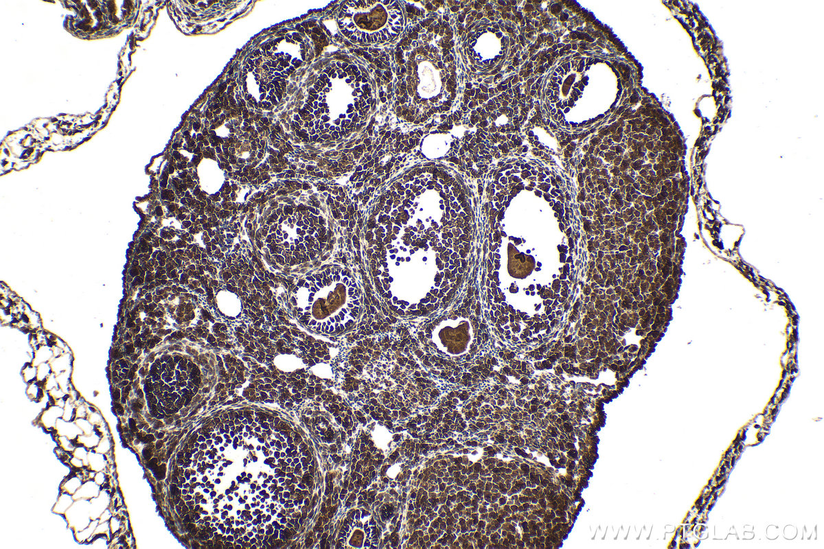 Immunohistochemical analysis of paraffin-embedded mouse ovary tissue slide using KHC2101 (PDE8A IHC Kit).