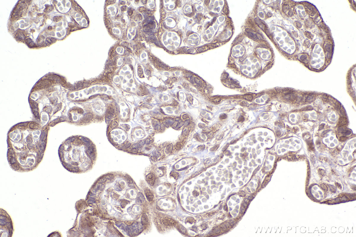 Immunohistochemical analysis of paraffin-embedded human placenta tissue slide using KHC2479 (PDK2 IHC Kit).