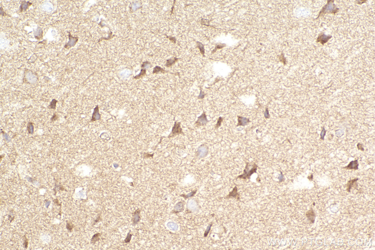 Immunohistochemical analysis of paraffin-embedded rat brain tissue slide using KHC2297 (PDLIM4 IHC Kit).