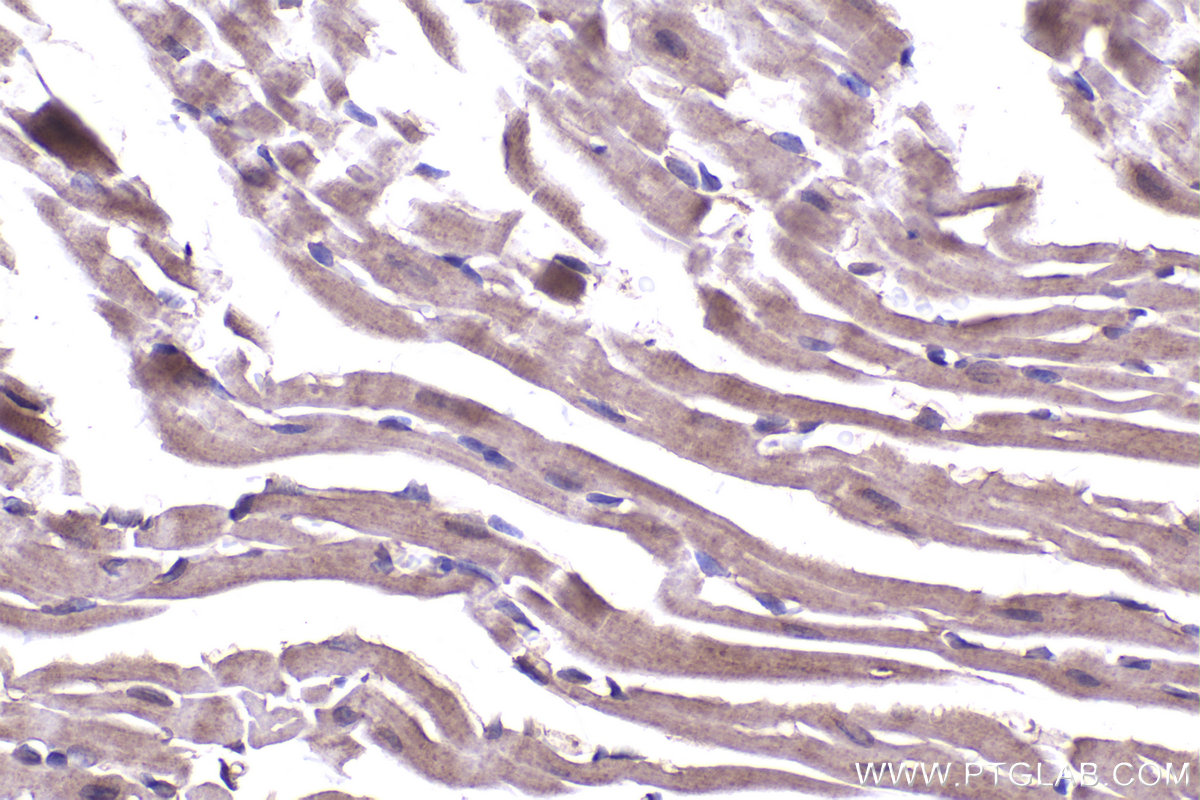 Immunohistochemical analysis of paraffin-embedded mouse heart tissue slide using KHC2349 (PEX5 IHC Kit).