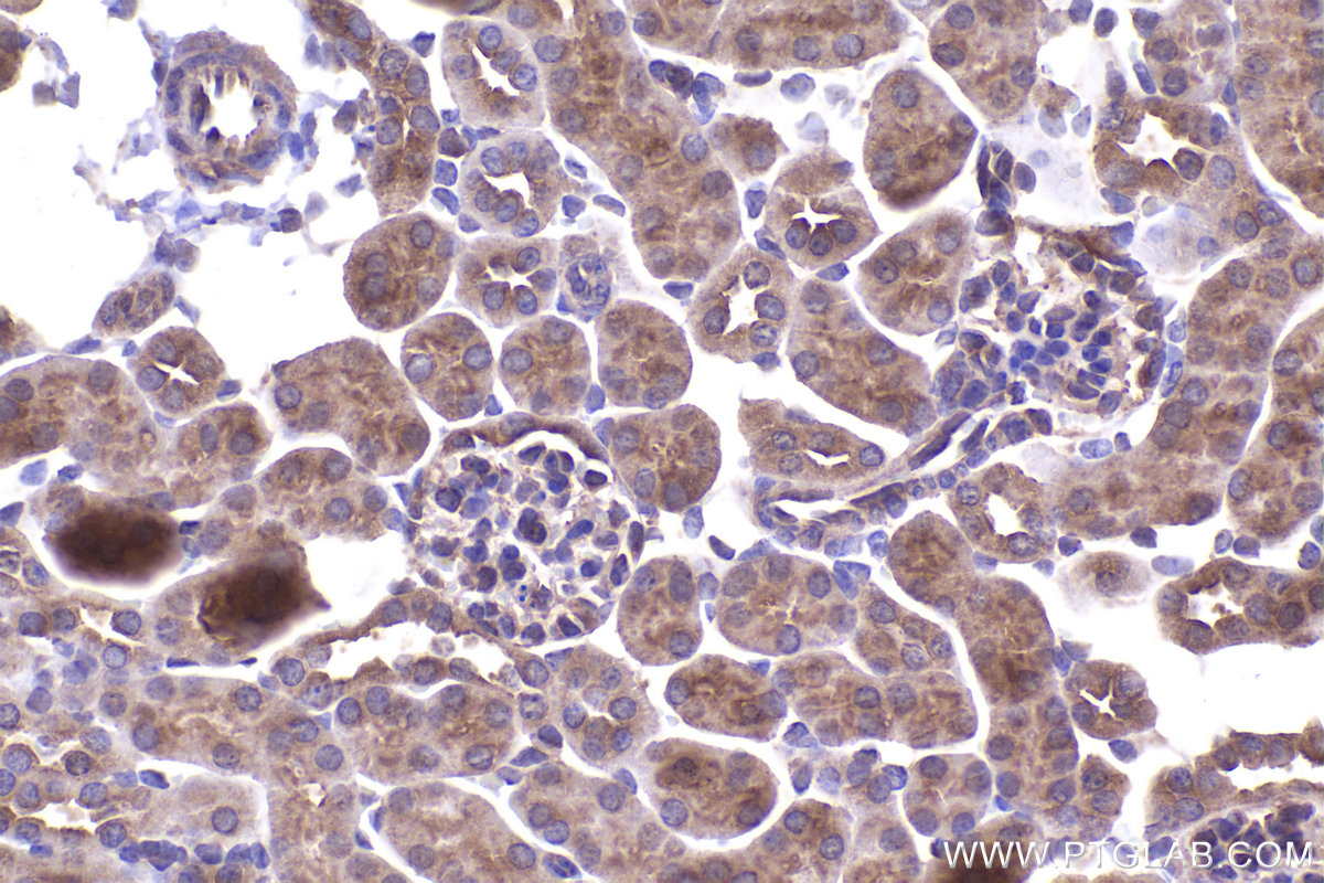 Immunohistochemical analysis of paraffin-embedded mouse kidney tissue slide using KHC2349 (PEX5 IHC Kit).