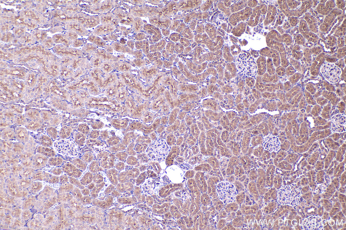 Immunohistochemical analysis of paraffin-embedded rat kidney tissue slide using KHC2349 (PEX5 IHC Kit).