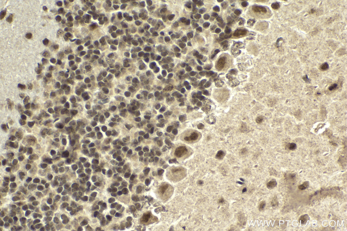 Immunohistochemical analysis of paraffin-embedded mouse cerebellum tissue slide using KHC2008 (PHF8 IHC Kit).